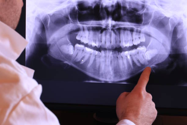 Best Emergency Care for Gum Disease in Washington, IL