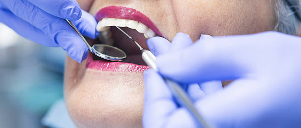 Best Broken or Chipped Tooth Repair in Washington, IL
